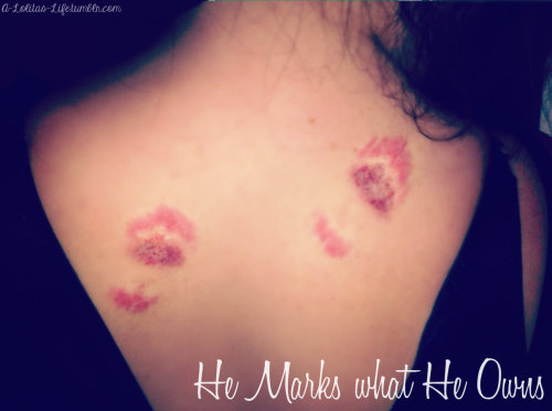 a-lolitas-life:  Daddy left some marks to remind me who’s feet I belong at. Thought I’d 