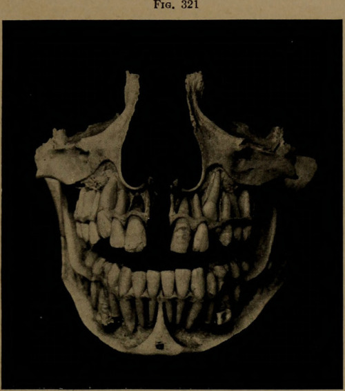 themarinevampireshop: Page 448 of ‘A text-book of dental histology and embryology, including laborat