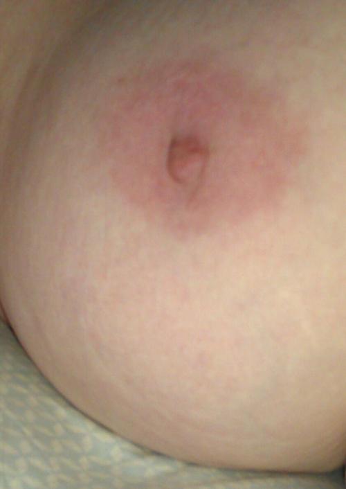 maryannehill:  MY BREAST FRIEND  Hi!  The other one was out of town today. It’s tough to photograph the same peaches over and over, and try to make them look new. Unfortunately, they always look the same to me.  And… probably to you, too.  ………………………………