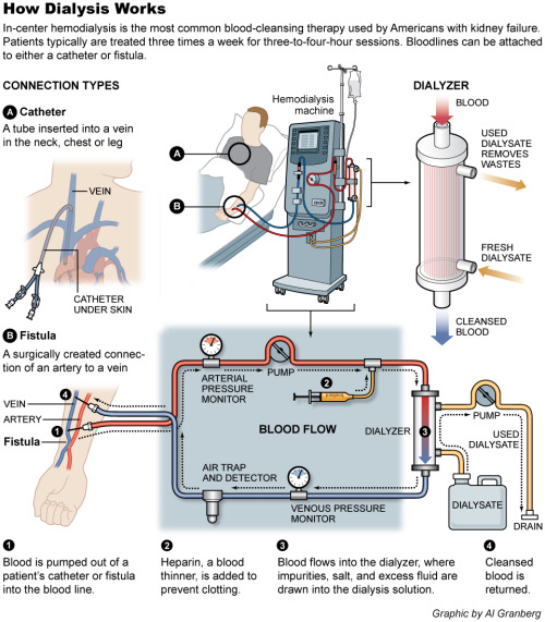 medical-school-infographic-on-how-dialysis-works