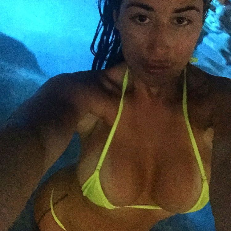 amateur-implant-pics:  d__p__johnston