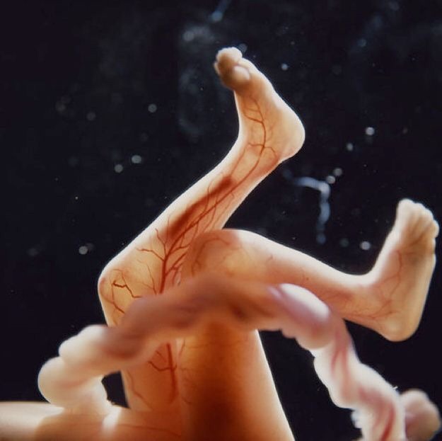 congenitaldisease:  The legs of a developing fetus. 