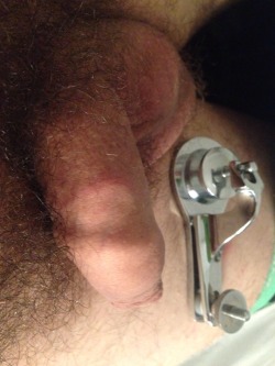 circfanuk:  Gomco marks… numb foreskin  The gomco is a tool not a toy! Cut that skin