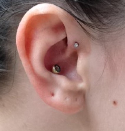 So I just had this little forward helix done. I LOVE the way it looks, but I hate the way it heals. 