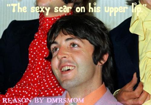 “The sexy scar on his upper lip.”- Reason to love Paul submitted by dmrsmom