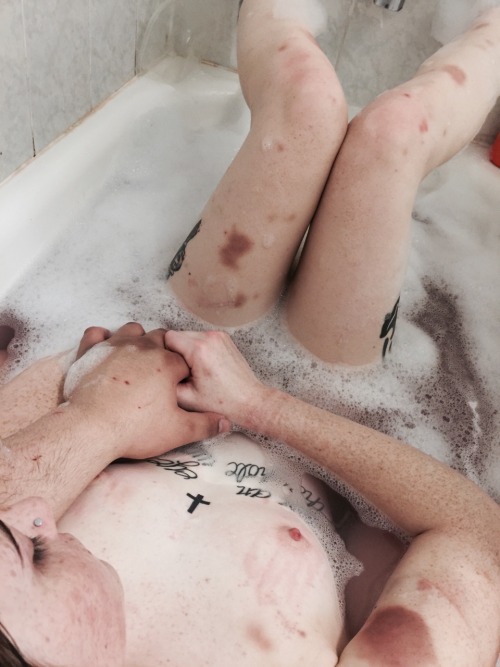 propainpapi: Baths after beatings