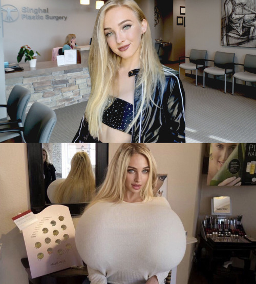 boobjobbitch: After her fifth boob job, she no longer thought of herself as a “woman”. She was now a
