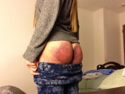 secretshelf:  sweet-little-submissive:  Oww! The metal end of the belt is not kind.  First time being bruised from spanking. More photos to come!  oh my!   The ruleset reblogged my post! Ahh!! Happy day!!