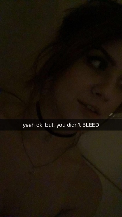 plantwitch:i’m very low lit and my mouth has a huge bruise on it