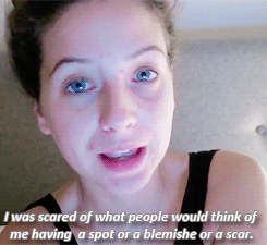 Zozeebo:  Your Skin Doesn’t Define You. 