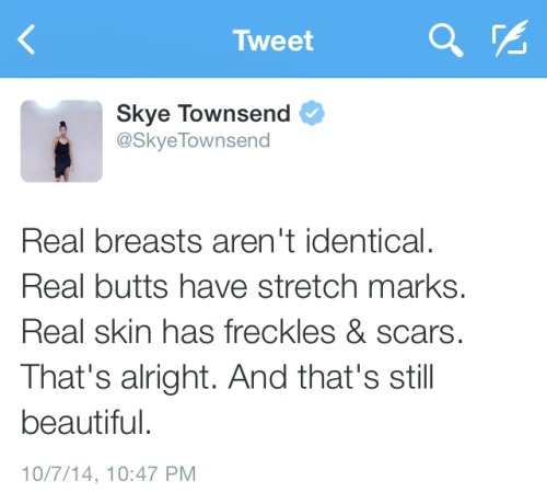 skyetownsend: Hey you, don’t beat yourself up over a stretch mark. You’re beautiful. Don