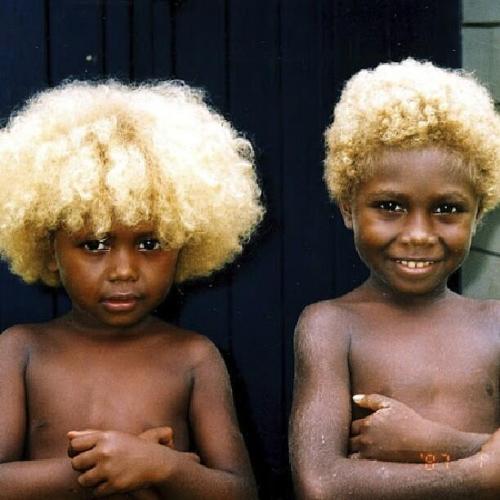 samuelernesto:Brown skin, blond hair 26% of the Melanesian people on the Solomon Islands are blond