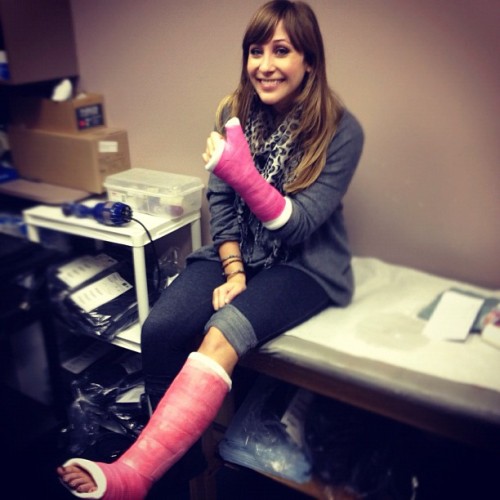 This girl looks pleased with her fresh short leg cast and short arm spica cast on her broken ankle a