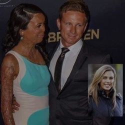 💙💙💙💙 I wish this kind of love for you, I wish this kind of love for me!  #Repost @achievetheimpossible ・・・ Via @6amsuccess  A True Gentlemen - The Australian ex-model Turia Pitt suffered burns to 65 per cent of her body, lost her fingers