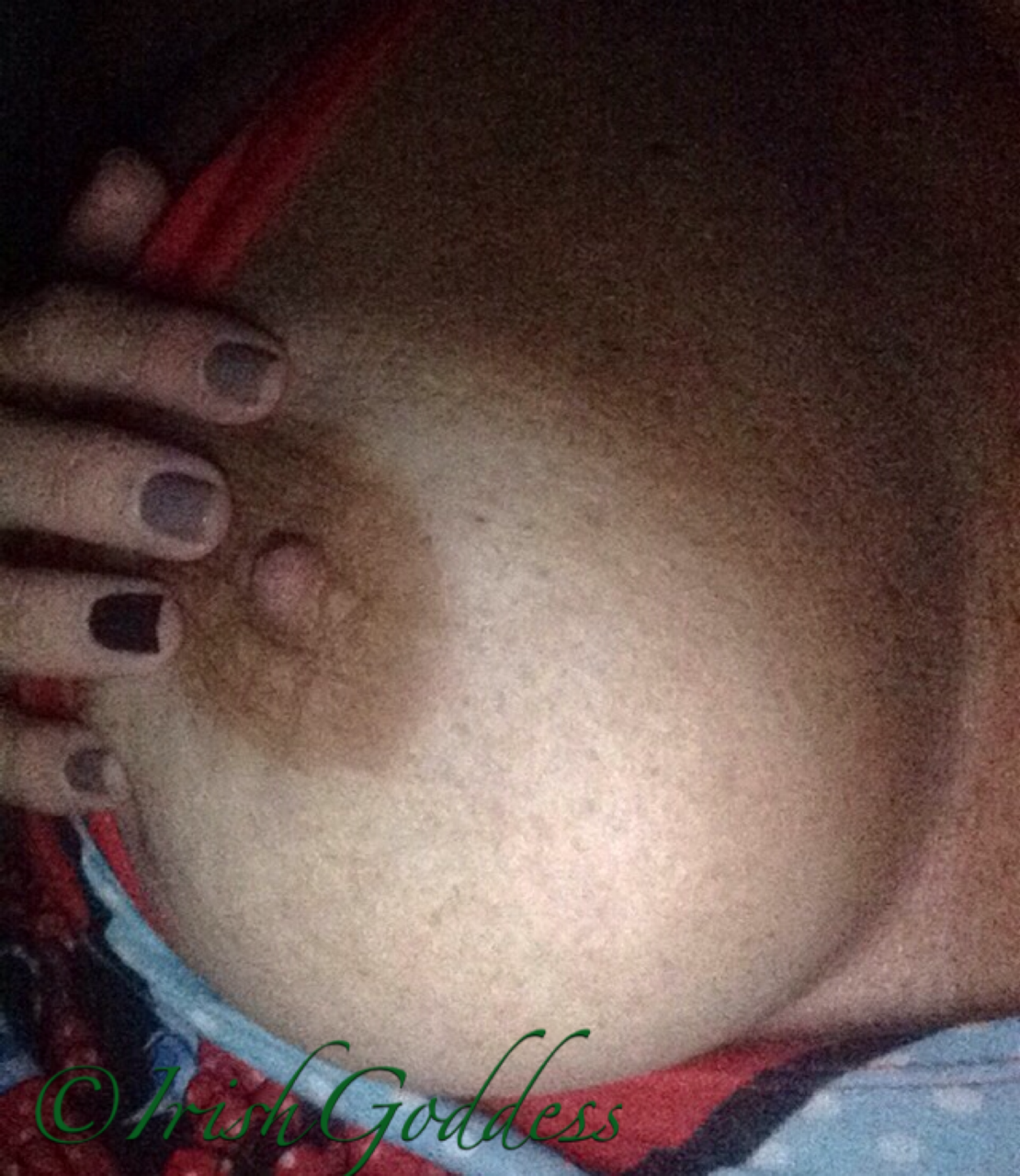 irishgoddessofloveandbeauty:  Nipples, nails and freckles 💚
