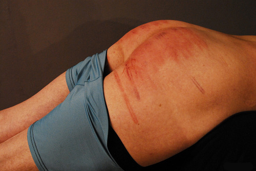 Remember ladies…a good caning SHOULD leave marks.