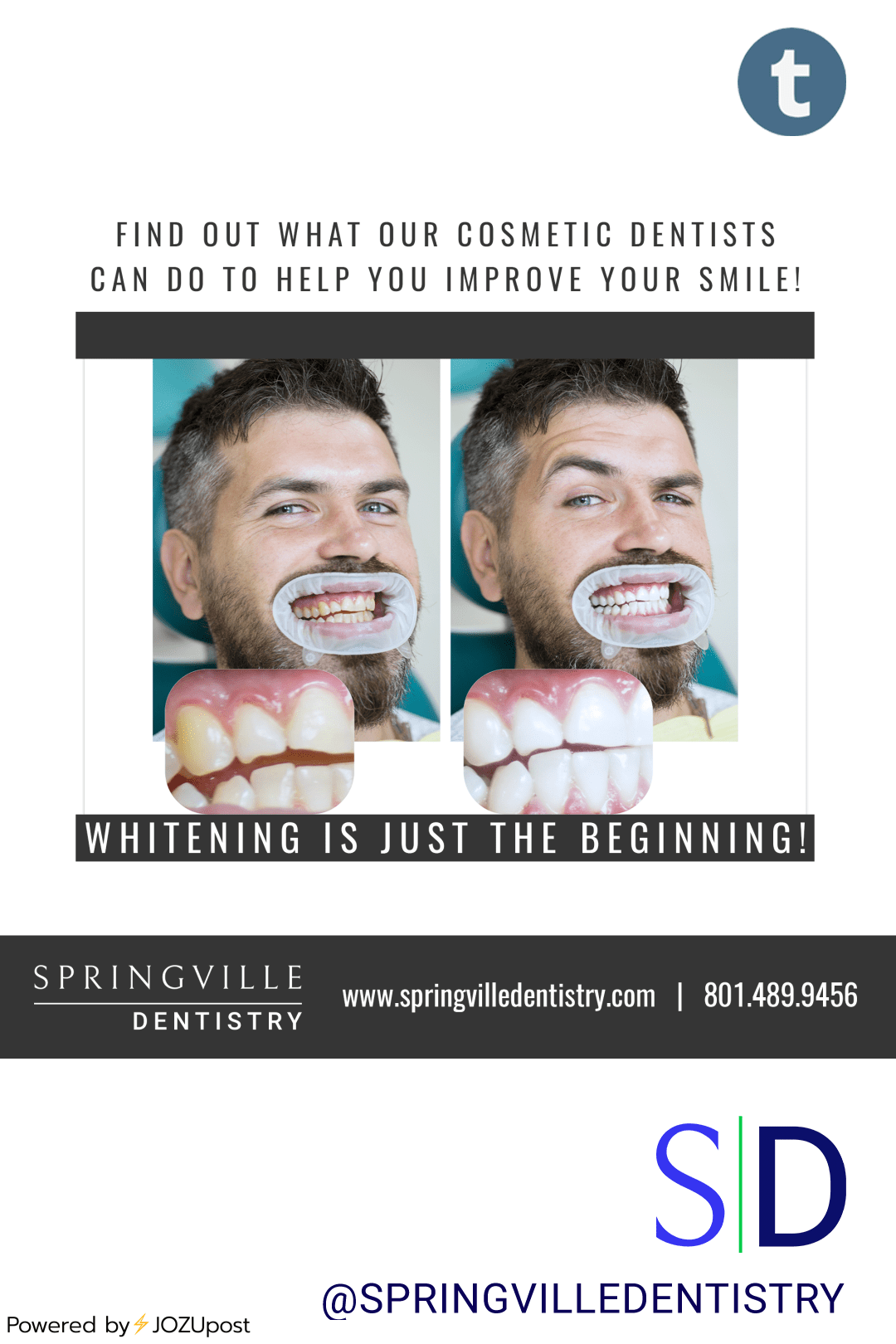 Whitening your teeth is an easy way to look younger, healthier and feel more confident according to a study done by Oral-B.
A high-quality smile makeover takes a skilled and artistic cosmetic dentist to complete the task.
At Springville Dentistry,...