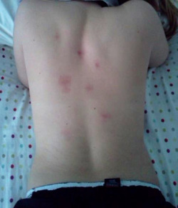 coldnost4lgia:  back hickeys feel so good omg