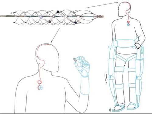 the-future-now:  New brain implant could move paralyzed limbs with just a thought It’s called a stent-electrode recording array, and it has been used for the last few years for neurological conditions, according to a paper  by University of Melbourne