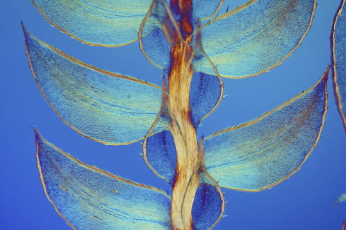 Some of the amazing winners of Nikon’s Small World Photomicrography Competition. Click on