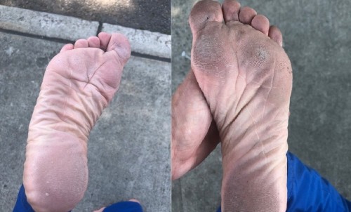 Dirty, calloused soles