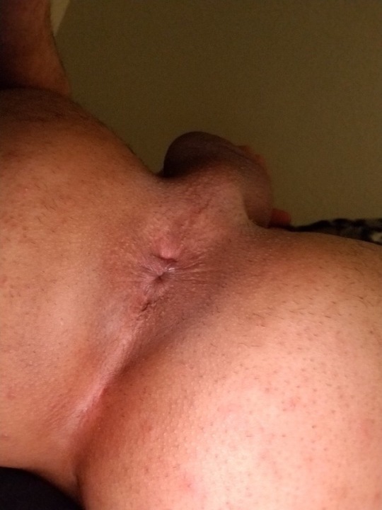 theholewhisperer:  