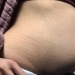 stuffingbelly:One month ago I bought a pair of jeans… Now they are so tight to leave marks on my skin. (That’s my breakfast belly after two big bowls of cereals with chocolate milk)