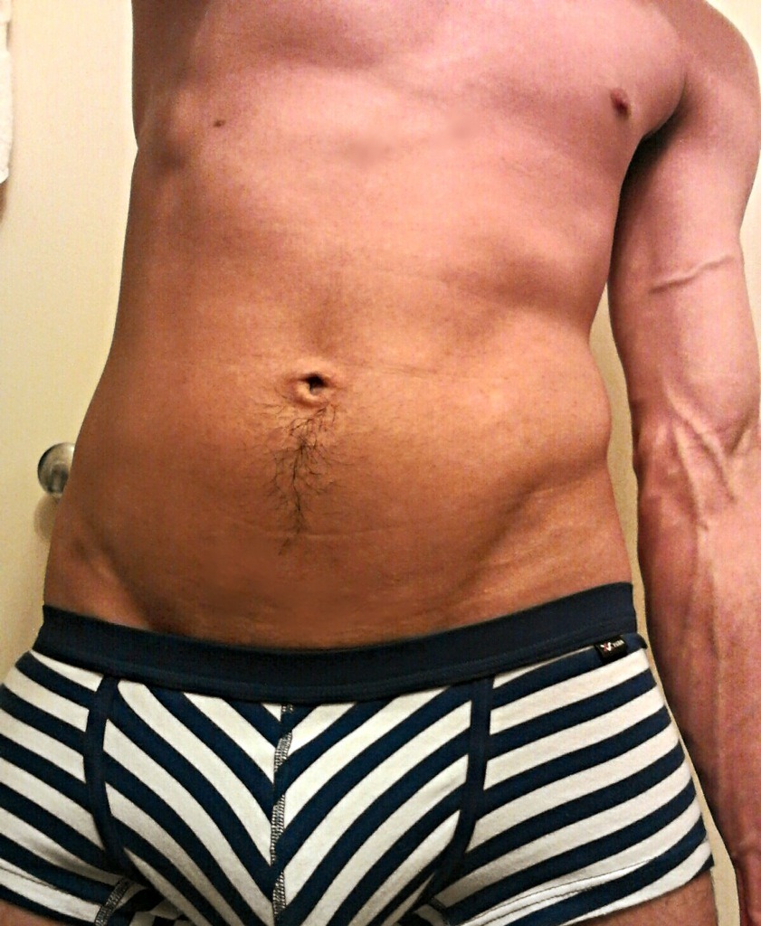 johnyrican:  Heroin veins