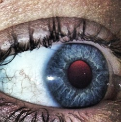 Took a picture of my eye and it went like