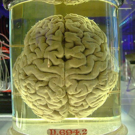 They Found Those 100 Missing Brains In Texas? I Was Hoping Those Clowns In Washington Got ‘Em!
A guy fed up with politics gives those clowns in Washington a piece of his mind — not that they’d know what to do with it! Amiright?