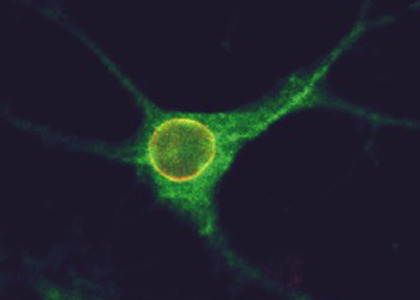 thenewenlightenmentage:
“New Clue to Autism Found Inside Brain Cells The problems people with autism have with memory formation, higher-level thinking and social interactions may be partially attributable to the activity of receptors inside brain...