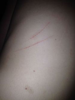 tunyi:  Auch  I DID THIS&gt; 