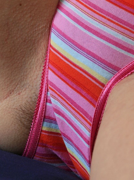 hairy-teeners:  Sally 18yo 