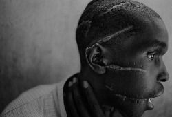 likeafieldmouse:  James Nachtwey - Rwanda (1994) Artist’s statement: &ldquo;I have been a witness, and these pictures are my testimony. The events I have recorded should not be forgotten and must not be repeated.&rdquo;