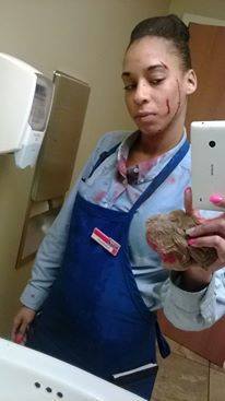 paptea:  malisssssse:  volumesofsilence:  aleerose:  kingjaffejoffer:  babybutta:  booksarerevolution:  katjagotboends:  indie-jack:  “My name is Jasmine Edwards. I worked at IHOP in Evansville, Indiana. As you can see I got hurt at work. A lady hit