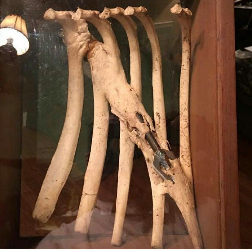 buy-skulls:  Wow! I just came upon this insane example of injury recovery! Here’s