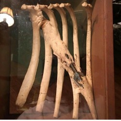 buy-skulls:  Wow! I just came upon this insane example of injury recovery! Here’s the description provided by the original poster:   “How cool is this?? The deer had been shot by a previous hunter years before and the animal got away and survived.
