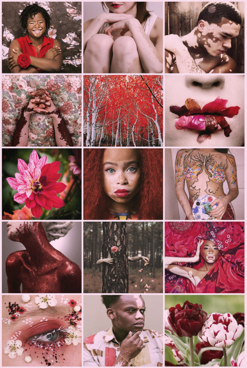 aestheticschaos:Vitiligo Fairy aesthetic