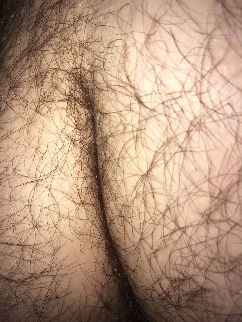 xxxnewstitch:  My big and hairy asssss