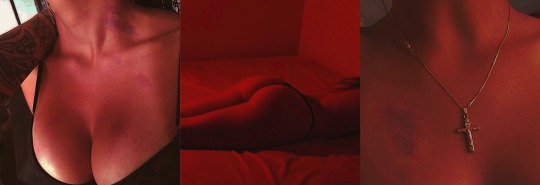 Tumblr media