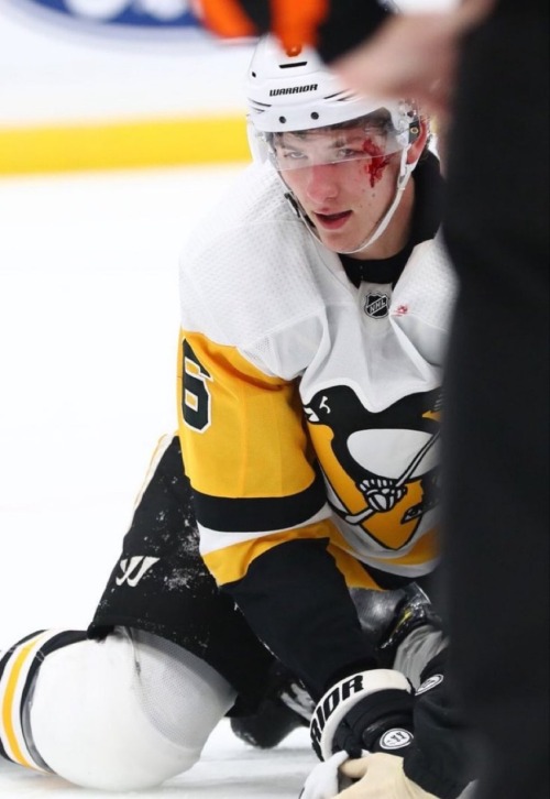 A Hockey Player Bleeding Sluttily Can Be So Personal...