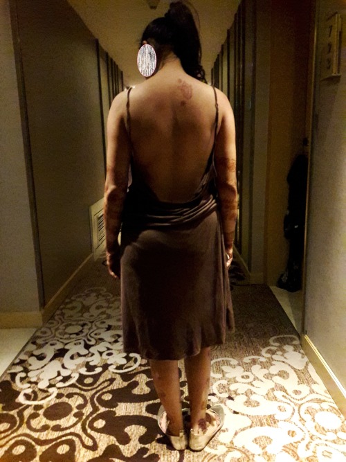 pankhurikunallkoblog:  Exposing in hotel’s corridor ….