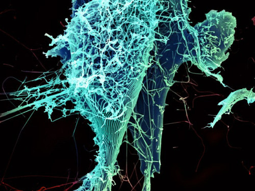 Evolution of Ebola Virus – Where are we now? Scientists continue to study the evolution of th