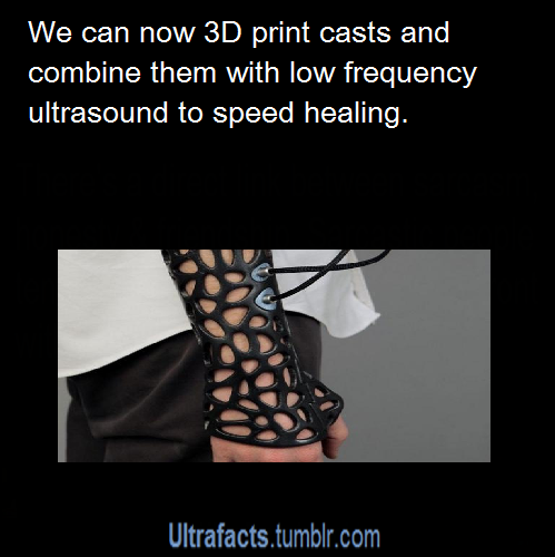 ultrafacts:  Source If you want more facts, follow Ultrafacts