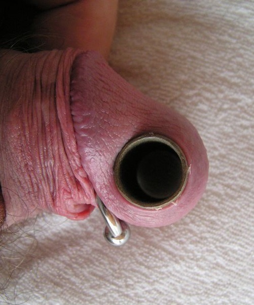 piercedsacks:  corn-man:big hole  Wonder what hi head size was before expanding it.