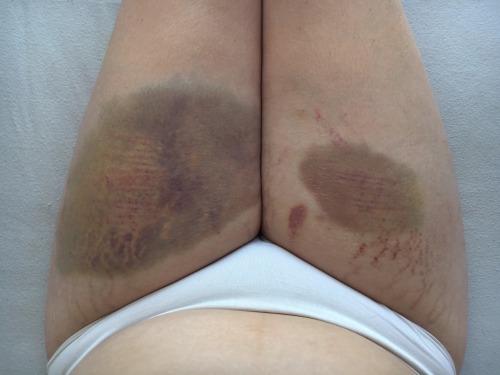 pervy-doll:  Hurt, Broken, Rebuild • please leave the post as is