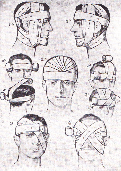 First aid bandaging techniques. Richards Topical Encyclopedia, 1962