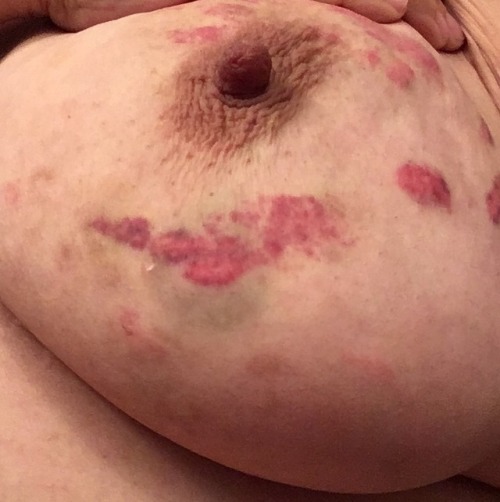 hans243: heygladgirl: The underside of my left breast on Thurs, Fri, Sat, and Sun. Thank you, Daddy.