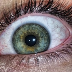 My eye lol