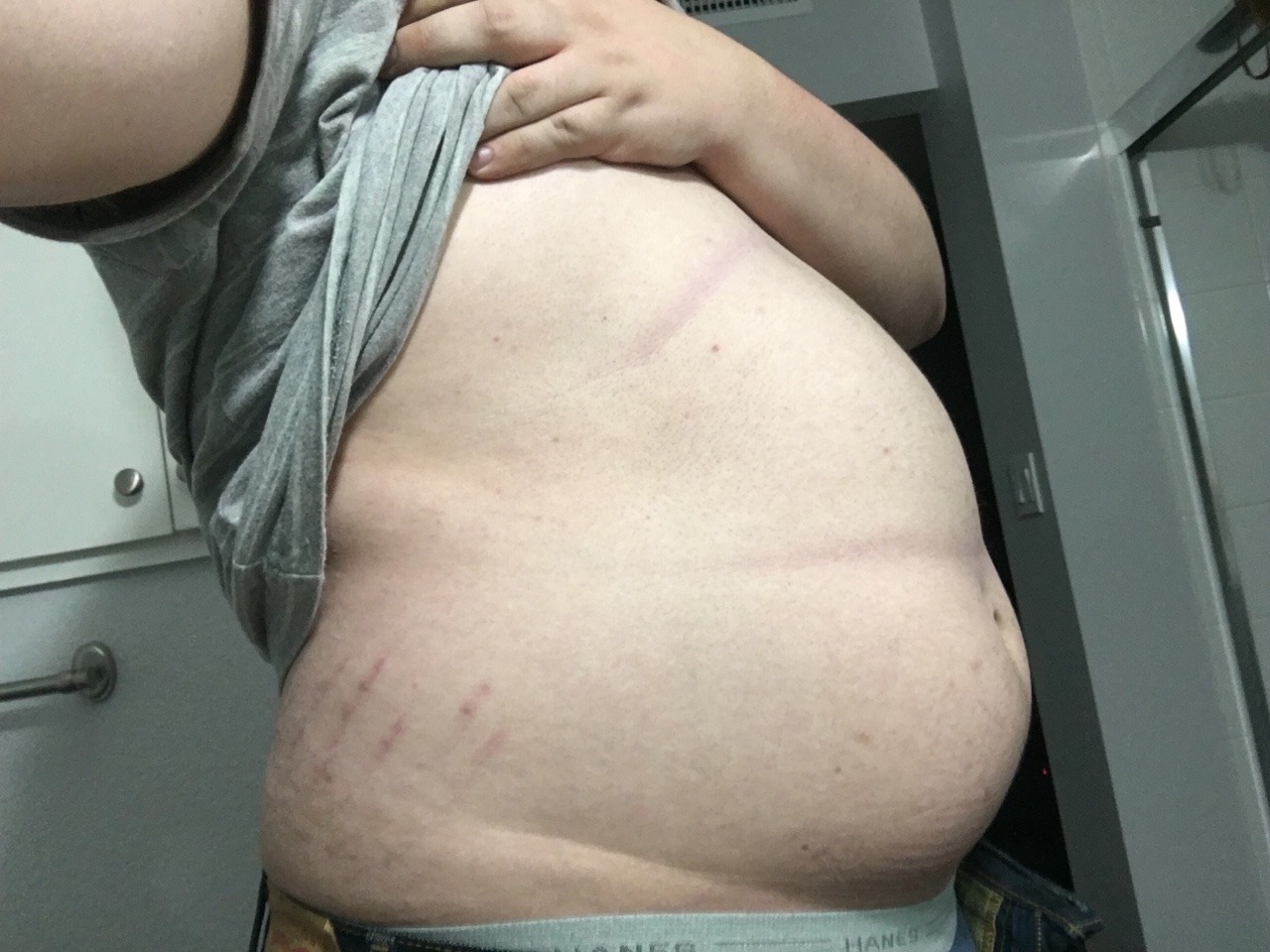 canihavethirds:Generic bathroom selfie Nice stretch marks!